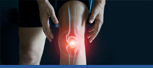 Computer Navigated Knee Repair Near Me in Gallatin, TN and Nashville, TN